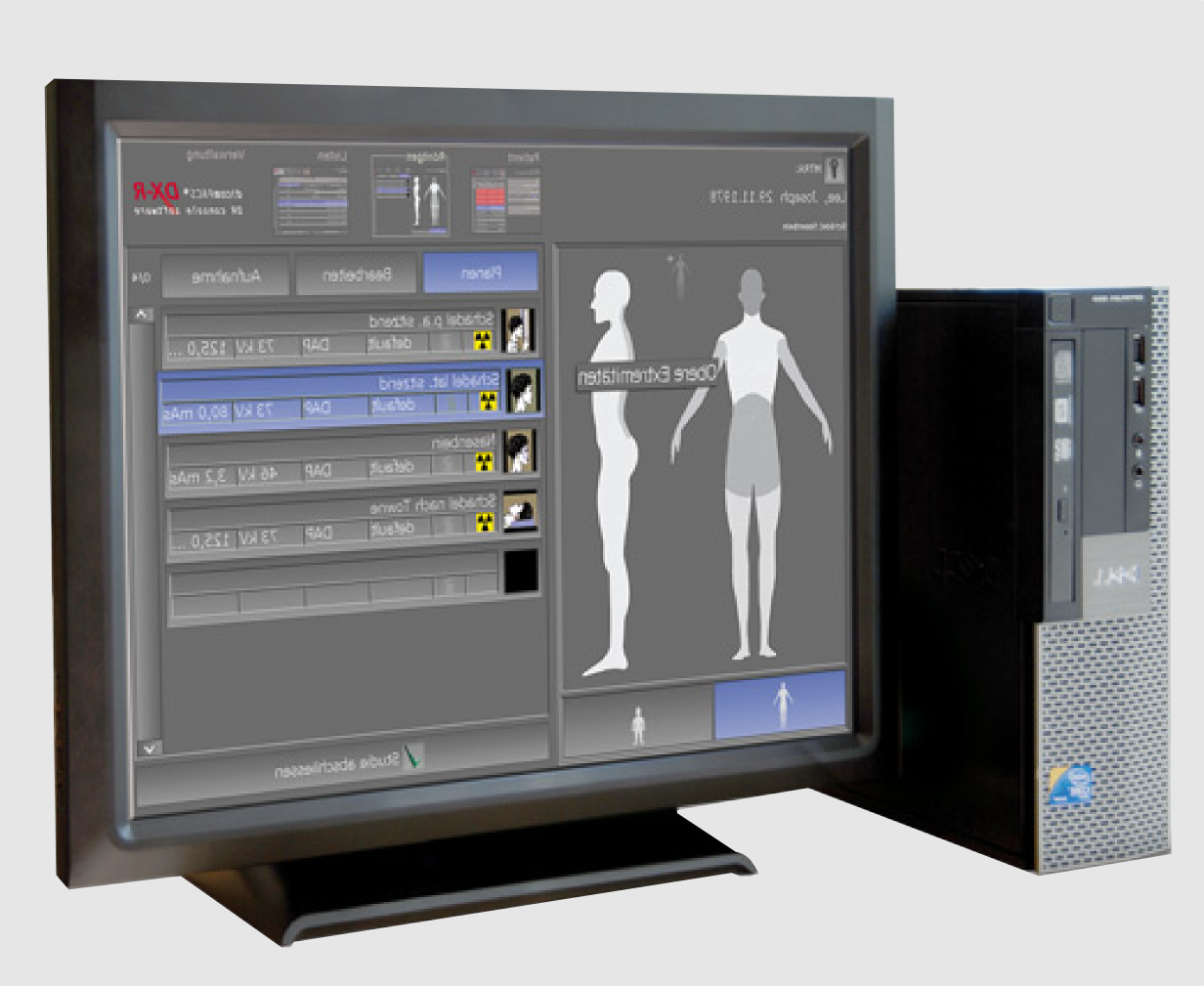 Logiciel de radiologie numérique